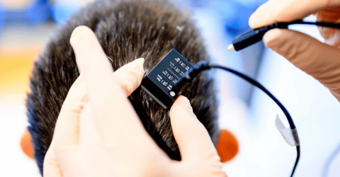 AI Restores Speech for People with Paralysis